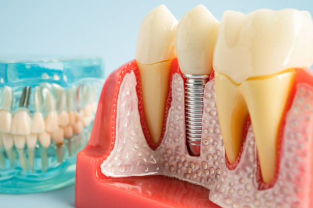 Best Dental Exams and Cleanings  in Lynchburg, OH